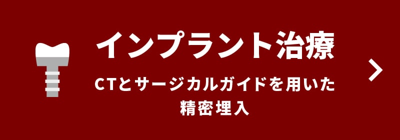 インプラント治療