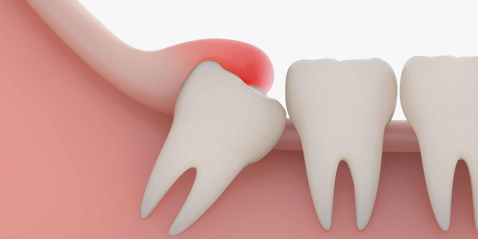 BRATダイエットって効果あるの?